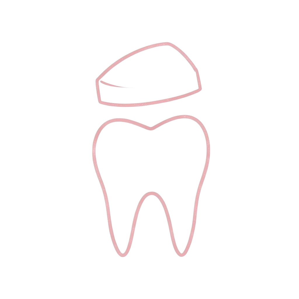 Ilustración de una corona dental sobre un diente